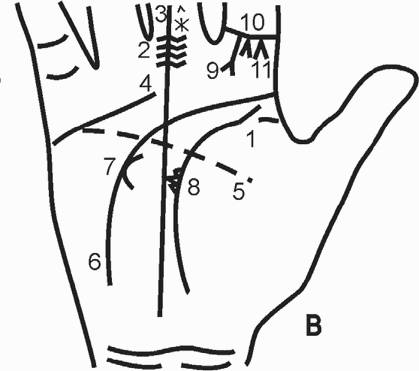 Вилка на конце линии жизни. Знак смерти на руке хиромантия. Смертельные знаки на руке. Обозначение смерти на руке. Смертельные знаки на линии жизни.