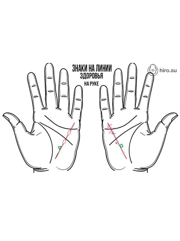 Линия здоровья. Линии на руках линия здоровья. Линия здоровья на руке хиромантия. Ориентация по ладони. Анализ по ладони.